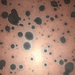 Metalier liquid metal copper patina