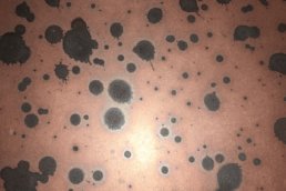 Metalier liquid metal copper with black patina